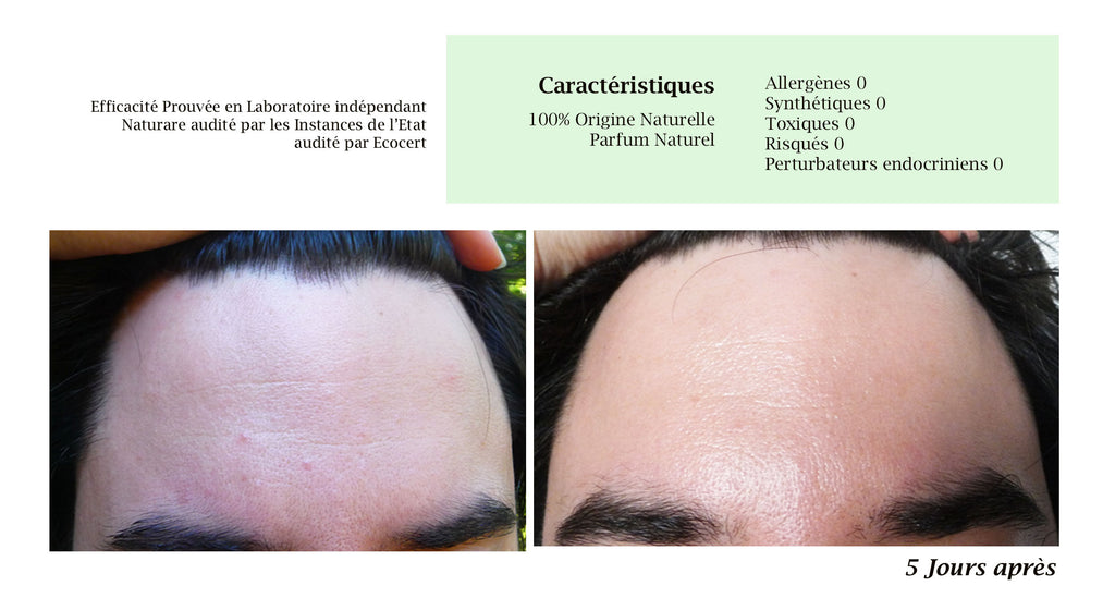 PRO - MERVEILLE DES LANDES BIO - Soin de peau Sensible Régénération Intégrale-13