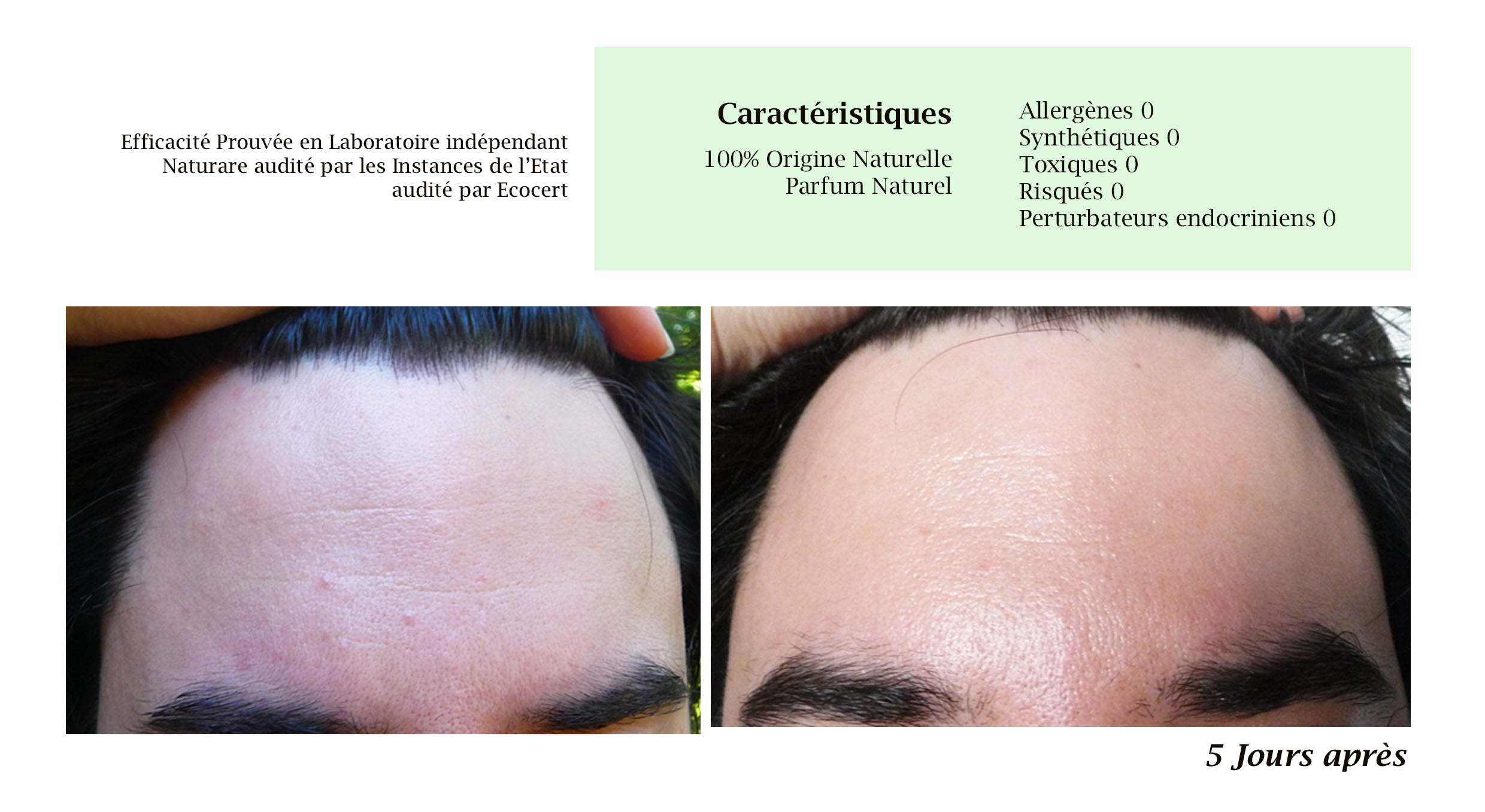 PRO - MERVEILLE DES LANDES BIO - Soin de peau Sensible Régénération Intégrale-13