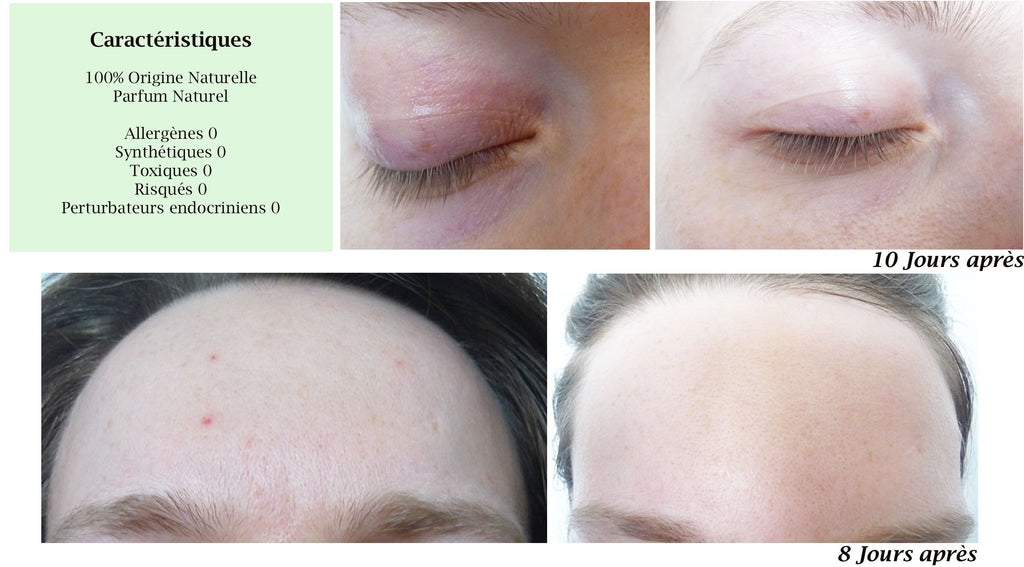 MERVEILLE DES LANDES BIO - Soin de peau Sensible Régénération Intégrale Visage