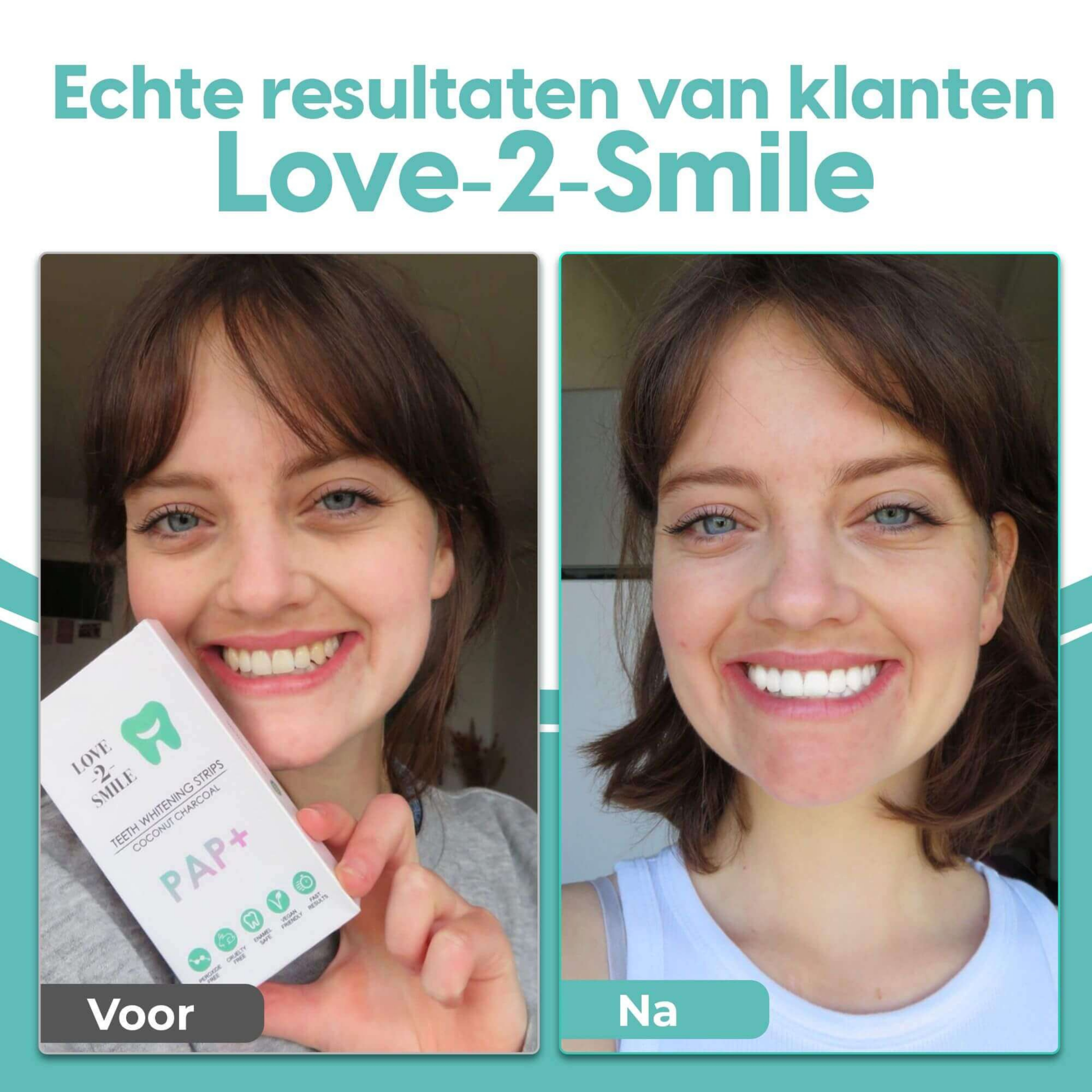 PAP+ Teeth Whitening Strips - 14 Day Treatment | 1+1 Bundle Deal